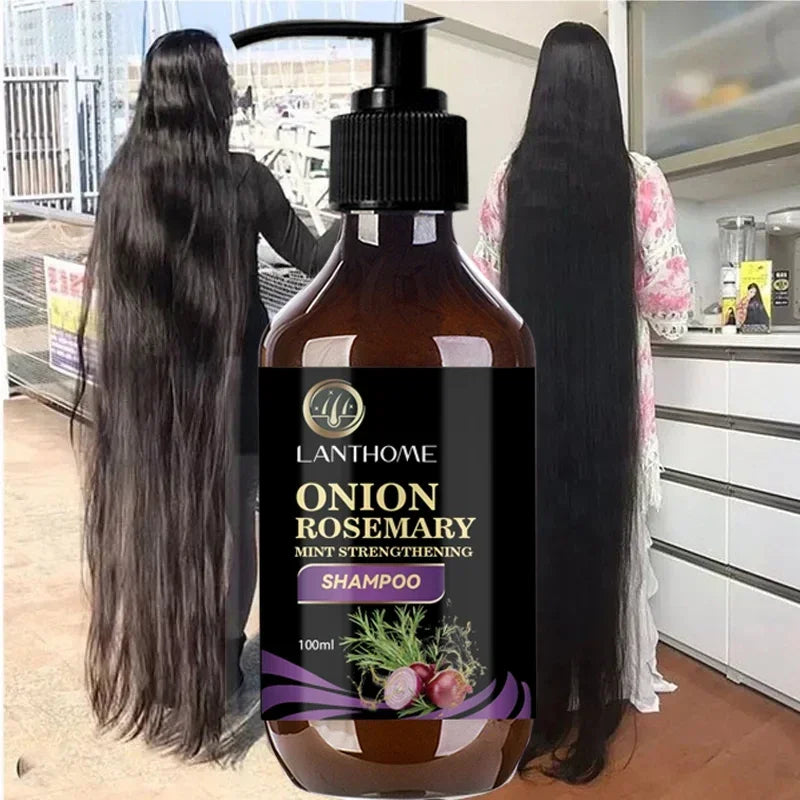 Hair Shampoo For Fast Hair Growth Rosemary Onion Hair Regrowth Shampoo Anti Hair Loss Effective Within 7 Day Hair Growth Product